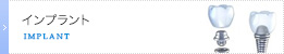 インプラント